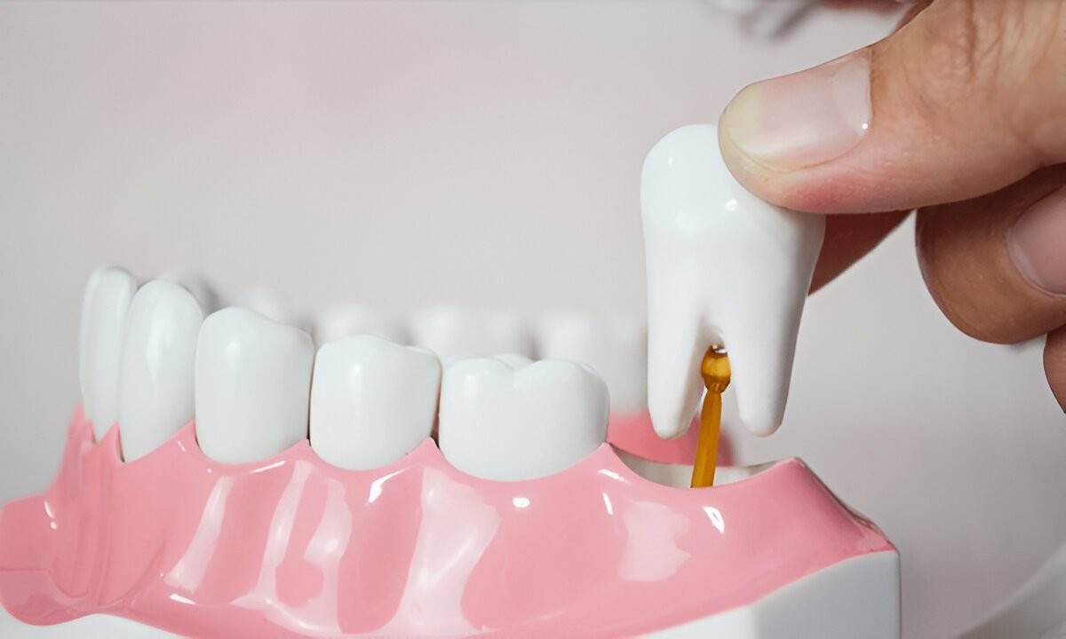Wisdom Tooth Removal Without Opioids: What the Latest Research Says